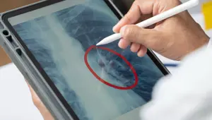 Yeni virüs alarmı: Arjantin'de kaynağı bilinmeyen gizemli zatürre vakaları hızla yayılıyor