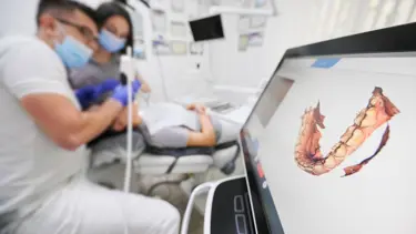 Diş hekimliğinde 3D tarayıcı ile ölçü alma derdi geride kaldı!