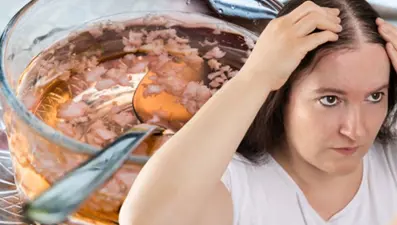 Kafasına sürenin 1 gecede saçı 2 kat çoğalıyor! Evde hazırlanan masrafsız saç çoğaltıcı kür