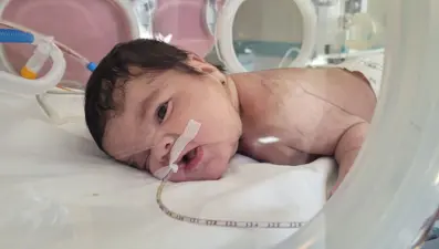 Dünyada 7'nci vaka: 34 haftalık doğan Eymen bebeğin boynundan çıkarıldı
