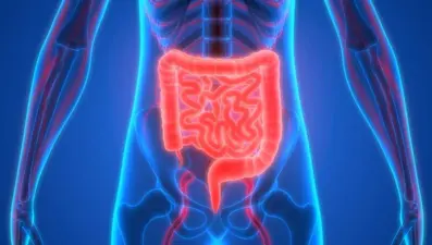 Geçirgen bağırsak sendromu nedir? (Geçirgen bağırsak sendromunun belirtileri nelerdir, nasıl tedavi edilir?)