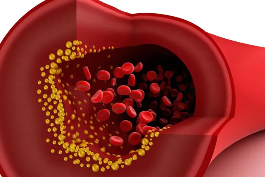 Yeşil çayın faydaları nelerdir? (Neden yeşil çay içmeliyiz?) 5 Yeşil çayın faydaları nelerdir? (Neden yeşil çay içmeliyiz?) 5