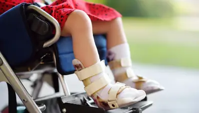 Serebral palsi (beyin felci) nedir, belirtileri nelerdir?