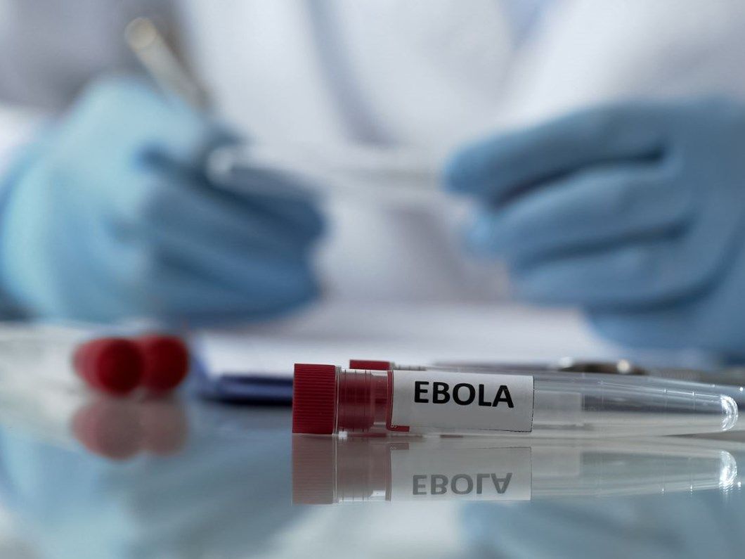 Gana'da Ebola vakası tespit edildi