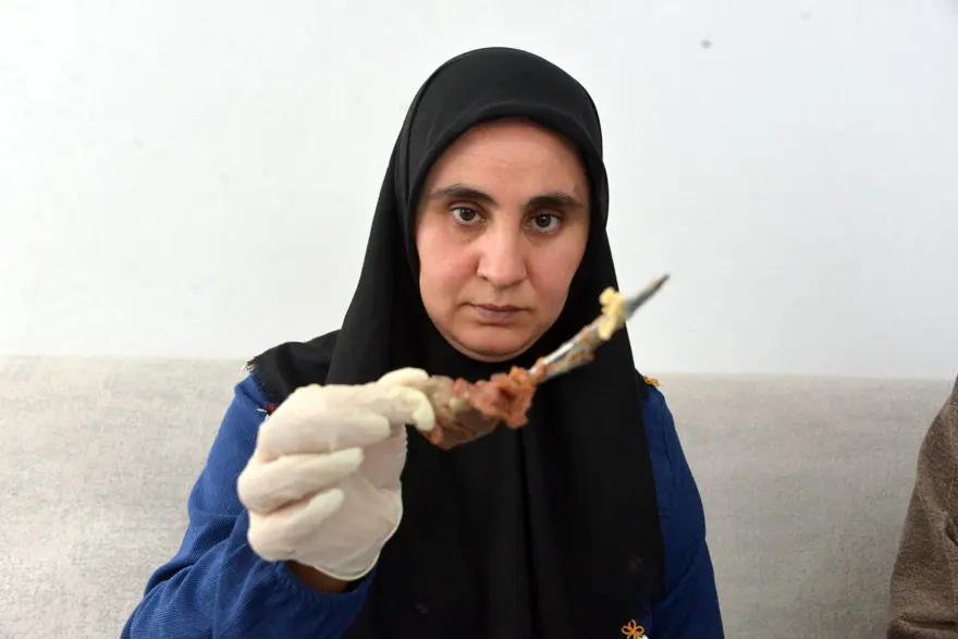 Karnında makas unutuldu,  7 yıl sonra böyle ortaya çıktı: "Mucize eseri hayatta kalmışım" 1