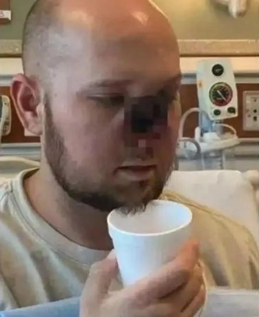 Milyonda 2 kişide görülüyor: Grip oldu, burnunu kaybetti 2