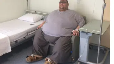 320 kiloluk gence obezite cerrahisi