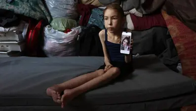 Ne teşhis ne de tedavi mümkün: Gazzeli çocuğun gizemli hastalığı