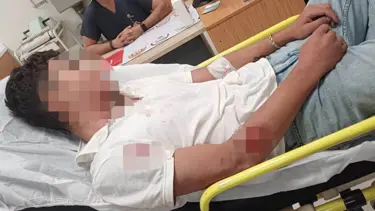 Ankara'da akran şiddeti: 14 yaşındaki çocuk hastanelik oldu