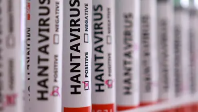 Türkiye'de hantavirüs vakası var mı? Sağlık Bakanlığı'ndan açıklama