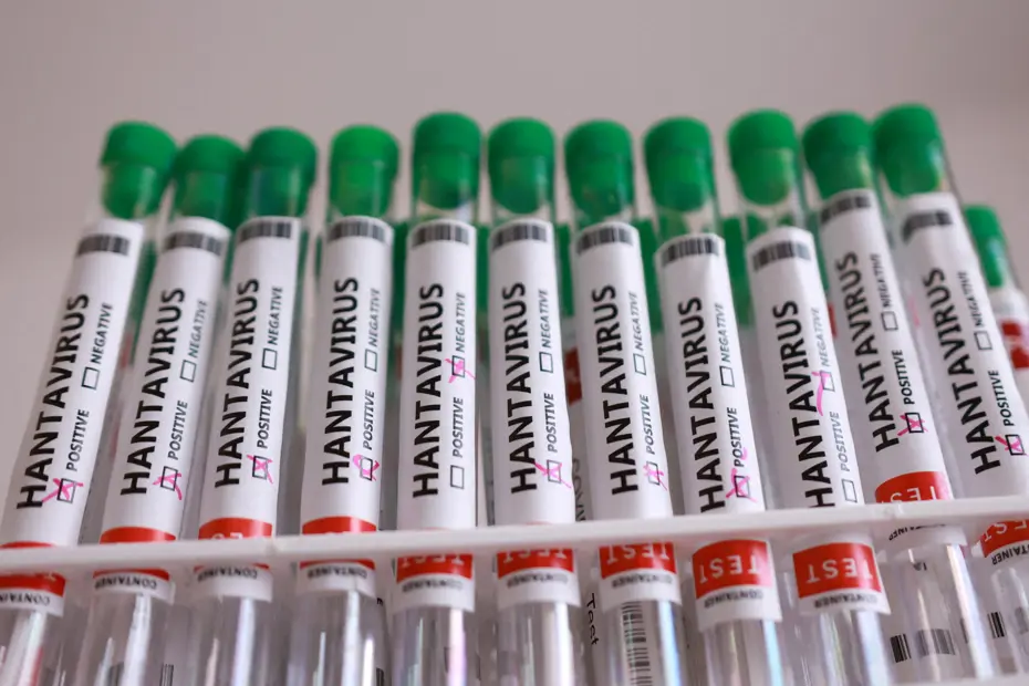 Fransa Sağlık Bakanlığı: Hantavirüslü yolcunun durumu kötüleşiyor