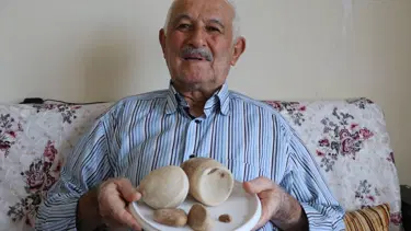 Mesanesinden 2,5 kilo taş çıktı, 'ömür boyu saklayacağım' dedi