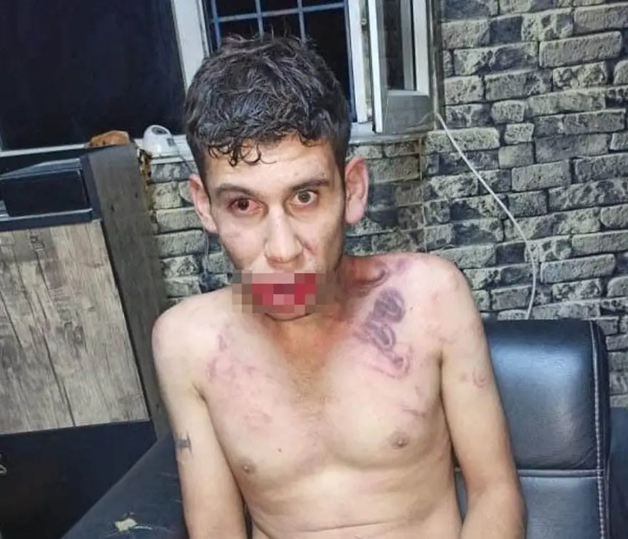 Antalya’da 2 gün süren korkunç işkencenin görüntüleri: Hamam böceği yedirip, dişlerini kerpetenle çektiler 1