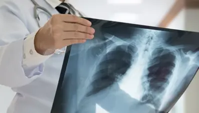 Verem en fazla ölüme yol açan enfeksiyon hastalığı