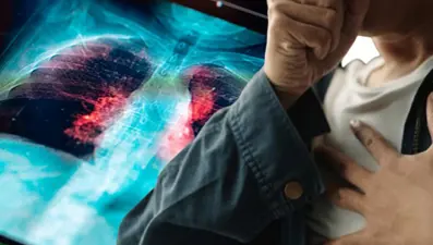 Öksürük şikayetiyle doktora gitti: Dudaklarının arasındayken yutmuş, akciğerinden çıktı