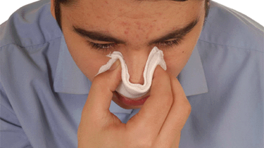 Burun kanamasını ciddiye alın!