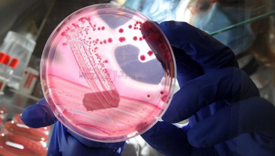 Prostat kanserinde yeni teşhis: Tükürükle tespit ediliyor