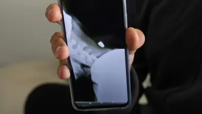 18yaşındaki Yunus Emre, 2 santimetreyle hayatta kaldı