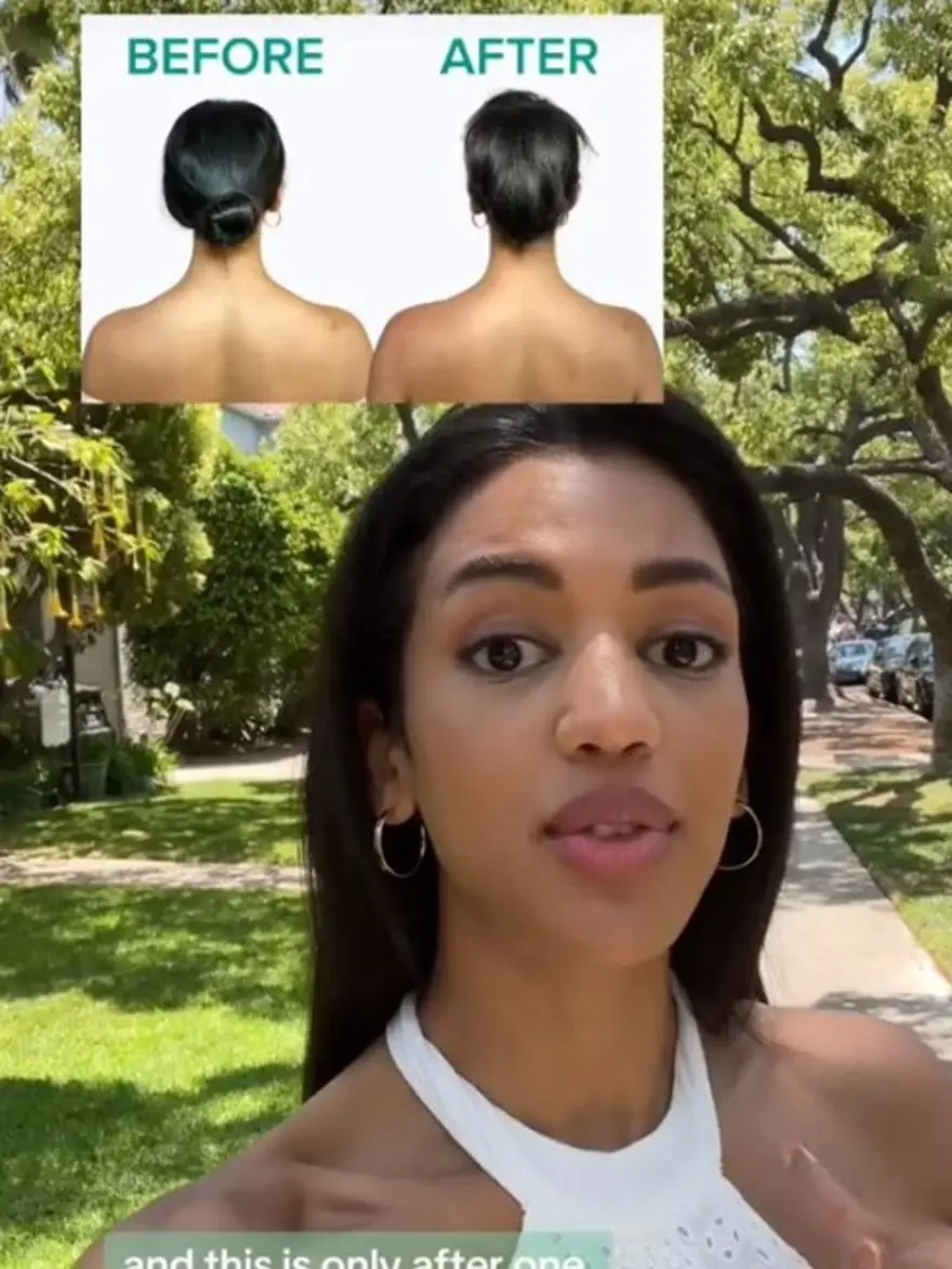 Yükselen trend: Barbie botoksu 3