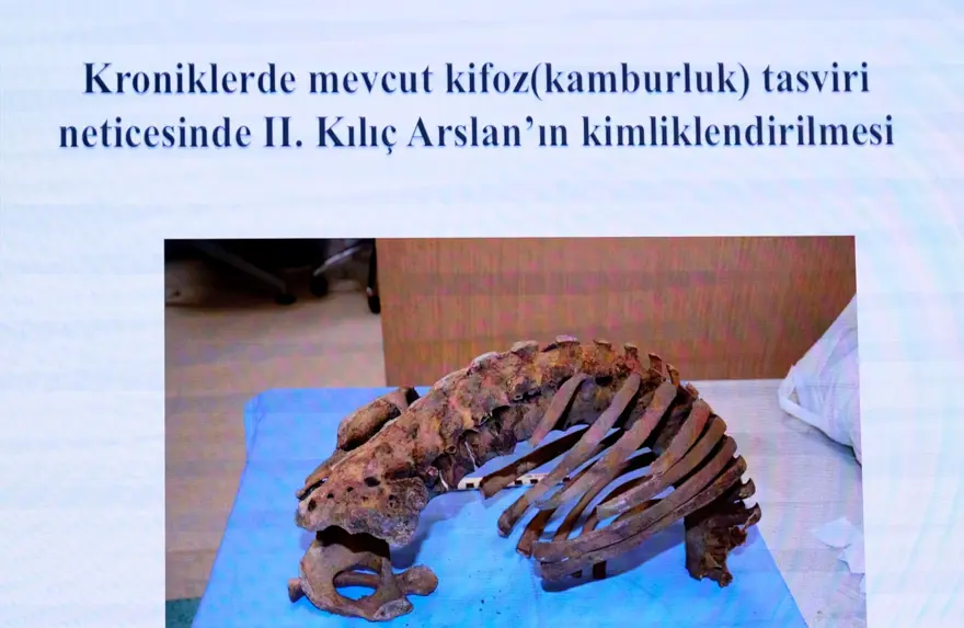 Selçuklu sultanlarının DNA analizi yapıldı: Hastalıkları ve ölüm nedenleri belirlendi 12