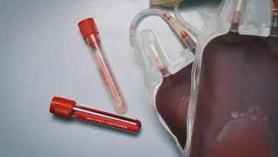 Kan merkezlerinde virüs tedbirleri