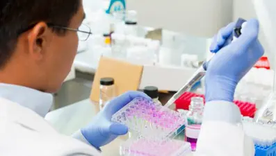 Türk hekimlerden karaciğer kanseri teşhisinde önemli çalışma