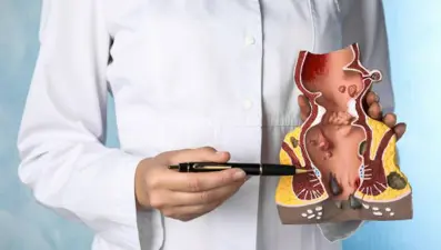 Fistül nedir, neden olur? Fistül belirtileri nelerdir, tedavisi nasıl yapılır?