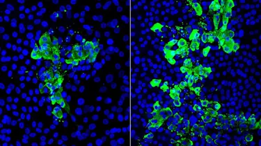 Corona virüste dikkat çeken araştırma: 3 kat daha fazla etkiliyor
