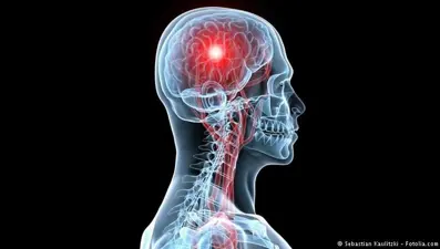 İnme uykuda bile gelebilir! (5 soruda inme gerçeği!)