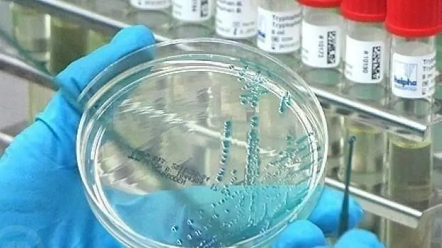 MAYMUN ÇİÇEĞİ VİRÜSÜ NASIL BULAŞIR? 2