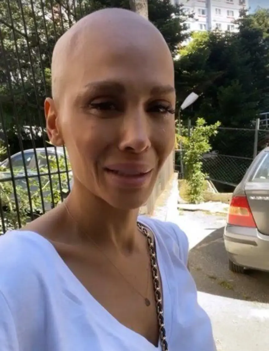 KANSER TEDAVİSİ GÖRÜYOR 1 KANSER TEDAVİSİ GÖRÜYOR 1