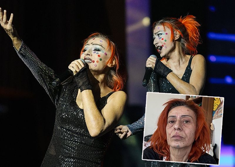 Yıldız Tilbe yüzündeki renkli beneklerle konser verdi
