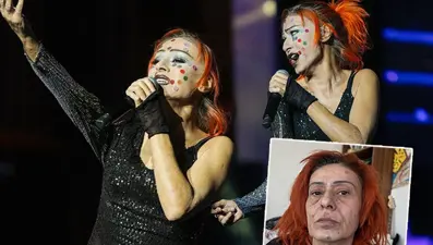 Yıldız Tilbe yüzündeki renkli beneklerle konser verdi