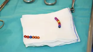 4 yaşındaki çocuğun bağırsağından 13 mıknatıs çıktı