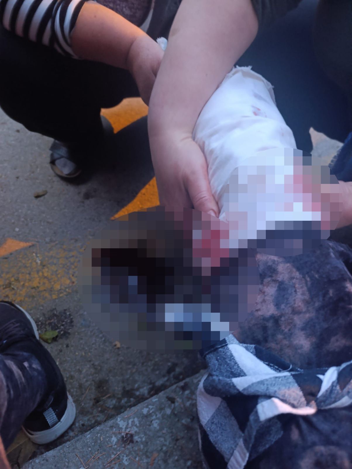 Ankara'da başıboş köpek dehşeti: Kadın akademisyenin bacakları ve yüzü parçalandı