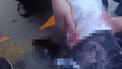 Ankara'da başıboş köpek dehşeti: Kadın akademisyenin bacakları ve yüzü parçalandı