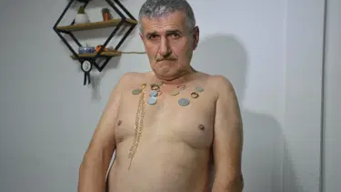 ‘Mıknatıs adam" etrafında ne varsa çekiyor: Tıp bunu açıklasın