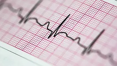 Bilim insanlarından düzensiz kalp atışını tespit eden kulaklık: 2 yıl içinde EKG'nin yerini alabilir