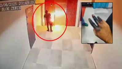 Elektrikli skuterin bataryası elinde patladı