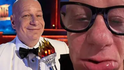 Dondurma yiyen ünlü komedyenin dudakları şişti, hastanelik oldu