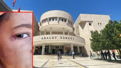 Öğrencinin yüzünde sigara söndüren temizlik görevlisi tutuklandı