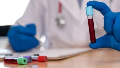 İngiltere'de semptomlar ortaya çıkmadan kanseri tespit edebilen test geliştirildi