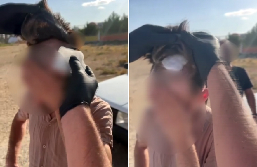 Polis şişlikten şüphelendi, peruğun altındanuyuşturucu çıktı 