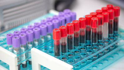 WBC nedir? Kan tahlilinde WBC değeri kaç olmalı? WBC yüksekliği ne anlama geliyor?