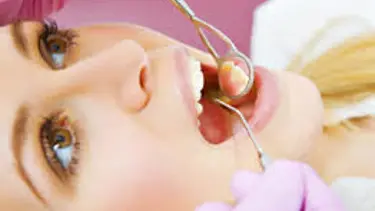 ‘Çürük diş kanserden koruyor’