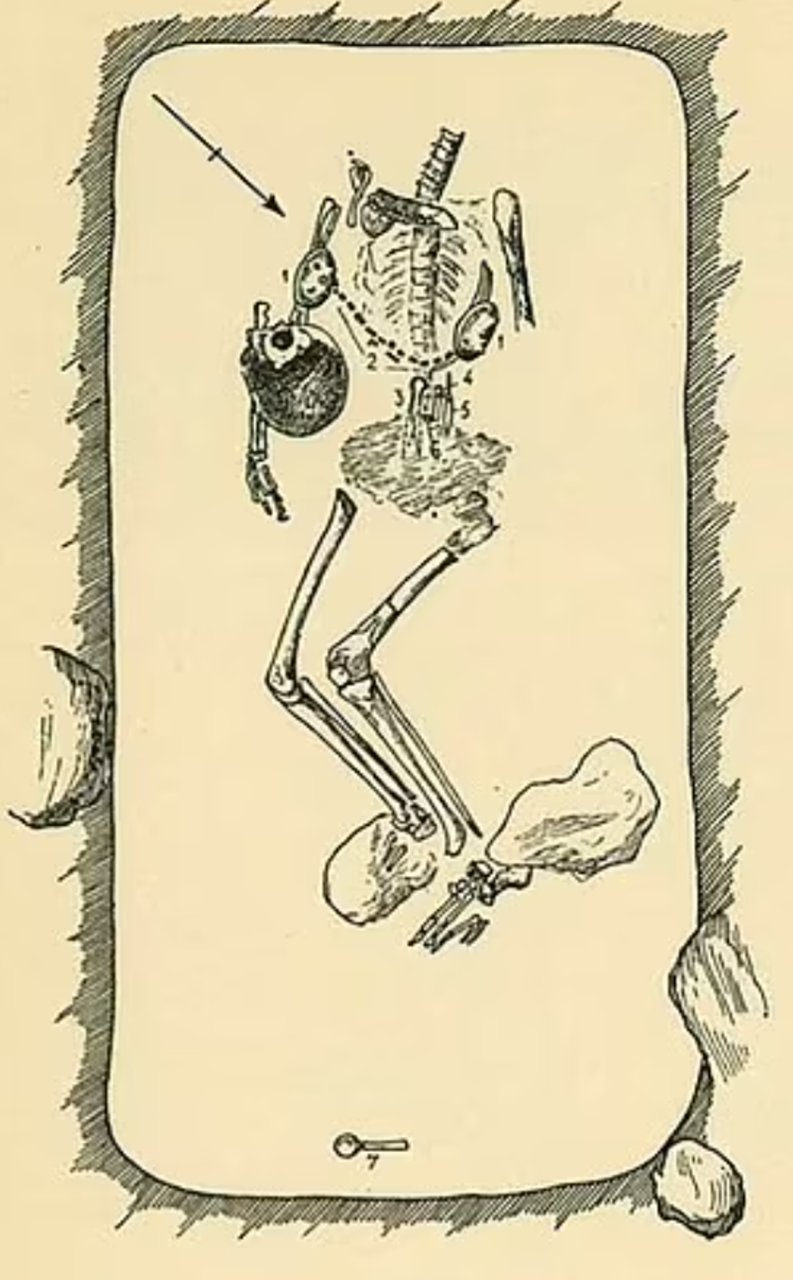 Vikinglerin kan donduran “kan kartalı” işkencesinin anatomik olarak mümkün olduğu kanıtlandı 12 Vikinglerin kan donduran “kan kartalı” işkencesinin anatomik olarak mümkün olduğu kanıtlandı 12