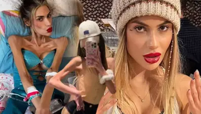 Anoreksiya nerzova yaygınlaşıyor: 15 yaşa kadar indi!