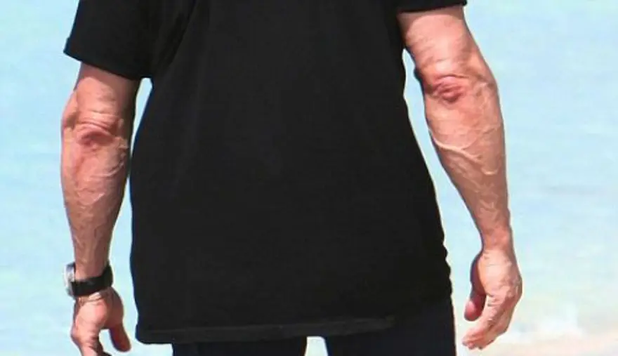 'Rocky' ne hale geldi! 6