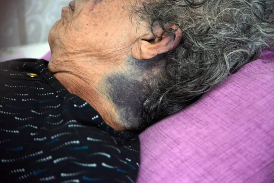 ÇIĞLIKLARINA KOMŞULARI YETİŞTİ 3 ÇIĞLIKLARINA KOMŞULARI YETİŞTİ 3