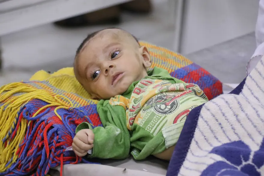 İnsanlık dramı: Sütten kesilen Afgan annelerin bebekleri büyüyemiyor 30 İnsanlık dramı: Sütten kesilen Afgan annelerin bebekleri büyüyemiyor 30